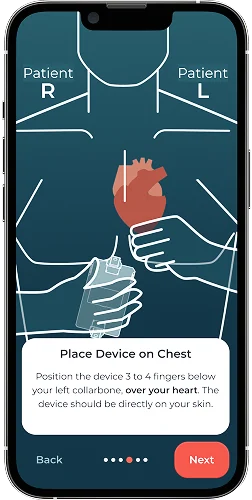 Patient app guiding device placement