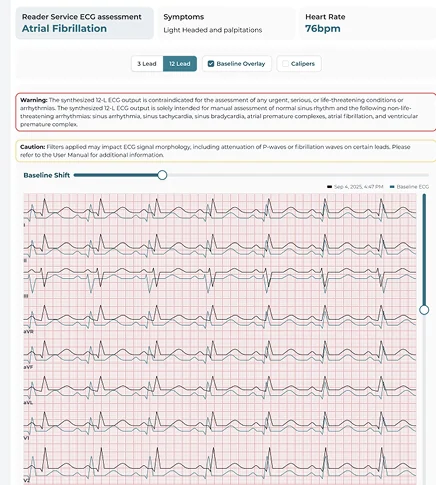 Clinician portal ECG report
