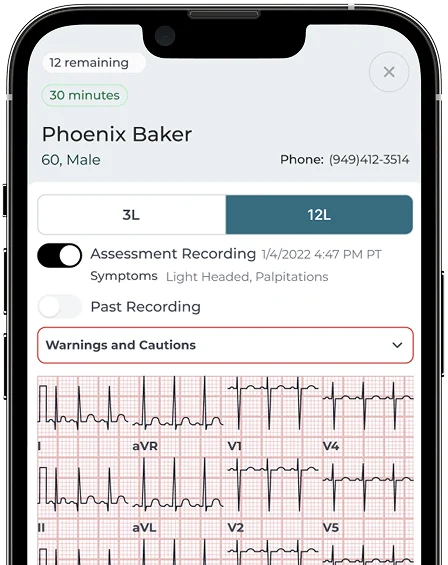 Reader app showing a 12-lead recording